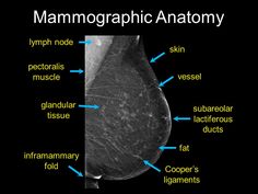 an x - ray shows the location of the mammagraphic anatomy