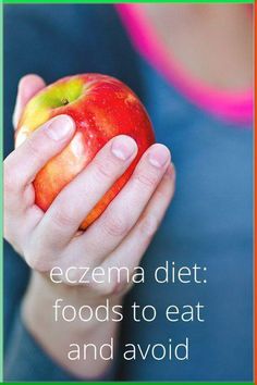 Eczema is an inflammatory skin condition with flare-ups that may be triggered by certain foods. Learn how to create an eczema-friendly diet. Growing Grape Vines, Recondition Batteries, Anti Itch Cream, Anti Snoring, Itch Relief, Skin Patches, Healthy Diet Tips, Skin Disorders, Skin Remedies