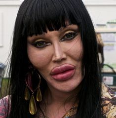 Plastic Surgery Pictures, Scary People, Botox Before And After, Pete Burns, Makeup Fails