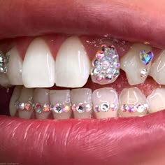 Teeth Accessories