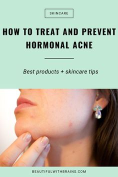 Do you always get pimples on your chin and jawline during your period? As your hormones fluctuate a week before you're due, your skin becomes oilier and more prone to pimples. Fear not. A few tweaks to your skincare routine and diet can make those pimples disappear for good. Click through to find out how I got rid of my hormonal acne. via @giorgiabwb Dry Acne Prone Skin, Treat Hormonal Acne, Shoulder Acne, Hormonal Acne Remedies, Cream For Acne, Acne Beauty