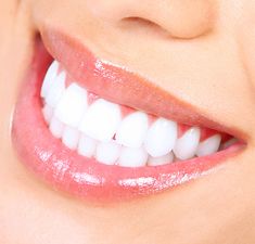 Hollywood Smile Teeth, Desired Smile, Zoom Teeth Whitening, Smiling Mouth, Teeth Whitening Methods, Hollywood Smile