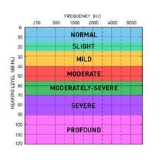 What Color Represents Hearing Loss. There are any references about What Color Represents Hearing Loss in here. you can look below. I hope this article about What Color Represents Hearing Loss can be useful for you. Please remember that this article is for reference purposes only. #what #color #represents #hearing #loss