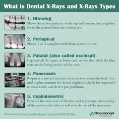 Dental Assistant Radiology Study, Dental Radiology Study, Dental Nurse Revision, Radiology Dental, Cbct Dental, Dental Radiography