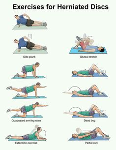 an exercise poster showing how to do back pain exercises