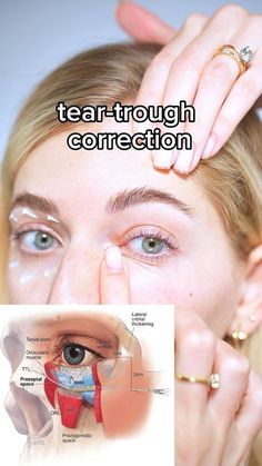 amazing massage for your eyes Apply a pea-size amount of moisturizer and follow these moves daily. Follow me for more face fitness techniques💛 #facefitness #facemassage #eyecream #facecare #crowsfeet #teartrough #beautyroutines | Valeriia Veksler | gibranalbo · Original audio Tear Trough Exercise, Exercise Face, Face Massages, Obličejové Masky, Face Fitness, Facial Massage Routine, Tear Trough, Massage Therapy Techniques, Face Yoga Exercises