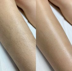 Wax Before After, Bella Hadid Hair, Cosmetic Web, Sugaring Hair Removal, Skin Care Pictures, Wax Strips, Diy Fashion Projects