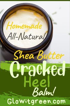 If there is one part of the body that is often neglected, it is the feet. Probably a case of out of sight, out of mind, it isn't until sandal weather that many realize they must do something about the dry, cracked skin on their heels and feet. Cracked heels are a common problem, especially Cracked Heels Diy, Foot Balm Recipe, Diy Healing Balm, Homemade Balm, Shea Butter Recipes, Heel Balm, Balm Recipe, Essential Oil Beauty