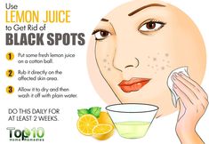 Black Spots On Face, Dark Spots Remedies, Top 10 Home Remedies, How To Get Rid Of Pimples, Dark Spots On Skin, Skin Spots, Spots On Face, Exterior Makeover