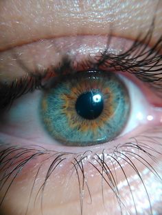 an extreme close up shot of the iris of a person's blue and yellow eye