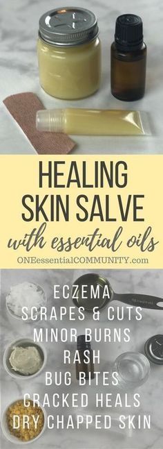 DIY all-purpose essential oil healing skin salve recipe: eczema, chapped skin, cracked heels, minor cuts, bug bites, bee stings, rash, burns, and more. Essential Oil Healing, Healing Salve Recipe, Healing Skin, Salve Recipes, Homemade Essential Oil, Healing Salves, Cracked Heels, Bug Bites