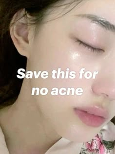 How I Cured My Acne, Tips On Clear Skin, How To Get Rid Of Forehead Acne At Home, How To Make Acne Disappear, Save This Pin For Clear Skin, How To Look Pretty With Acne, What Helps Acne, How To Get Rid Of Acne Scabs Overnight Dark Spots, No Acne Clear Skin