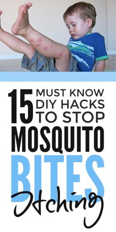 Mosquito bite remedy - DIY insect bite relief to stop the itch and swelling fast with homemade remedies from stuff in the house including essential oils. Help prevent swollen redness and safe for kids. #naturalremedies #naturalremedy #diyremedies #insects #insectrepellent #naturaltreatments #mosquito #mosquitorepellent #kidshealth #naturalhealth Misquote Itch Relief Diy, Mosquito Photography, Mosquito Bite Remedy, Mosquito Bite Relief, Mosquito Bite Itch, Remedies For Mosquito Bites, Bug Bites Remedies, Bug Bite Relief, Bite Relief