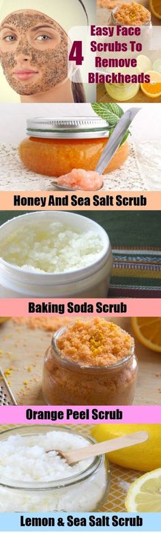 Remedies For Blackheads, Baking Soda Scrub, Blackhead Remedies, To Remove Blackheads, Blackheads On Nose, Fresh Aloe Vera, Face Scrubs, Face Care Tips