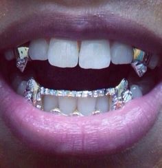 jewels grillz spiked teeth gold vampire teeth bling yonce jourdan dunn grillz grillz vampire grills swag mother of pearl gotta have it gold dope style diamonds platinum canine k9 fang grillz diamond grillz fashion dope wishlist grillz where did u get that make-up fangs sparkle diamonds shiny lip make-up Vampire Teeth