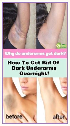 Supreme information. Skin Hacks, Unwanted Hair, Care Tips