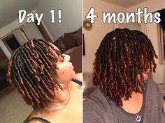 Comb Coil Locs Styles, Coil Locs With Curly Ends, Starter Locs Styles Comb Coil Medium, Comb Twist Locs, Coil Locs Vs Two Strand Twist Locs, 2 Month Starter Locs, 1 Month Locs, Comb Coils Locs, Coil Locs Starter