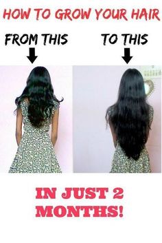 DIY Grow Hair faster | 10 Remedies to grow hair faster in a week How To Grow Your Hair Faster, Grow Long Hair, Hair Treatments, Grow Hair Faster, Hair Growth Tips, Hair Regrowth