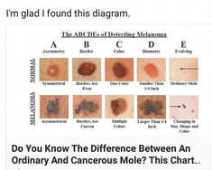 Mole Meaning, Cancerous Moles, Red Moles, Nose Picking, Yoga Information, Reflux Diet, Acid Reflux Diet