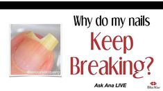 Why My Nails Break So Easily. There are any references about Why My Nails Break So Easily in here. you can look below. I hope this article about Why My Nails Break So Easily can be useful for you. Please remember that this article is for reference purposes only. #why #my #nails #break #so #easily My Nails, Nails Design, Spring Nails