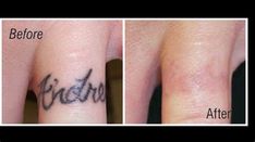 before and after photos of a tattoo on someone's wrist