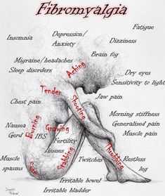 Fibromyalgia & Chronic Painn Leg Spasms, Fibermyalgia Symptoms, Muscle Twitching, Jaw Pain, Irritable Bowel, Migraine Headaches, Heart Problems, Chest Pain, Dry Eyes