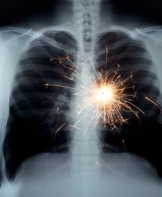 an x - ray image shows the chest with fireworks in it