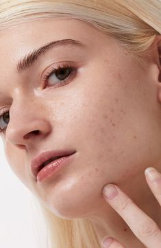 Sensitive Skin Aesthetic, Acne Is Beautiful, Blemish Patches, Texture References, Skincare Texture, Hydrocolloid Patches, Facial Services, I Dew Care, Skincare Science