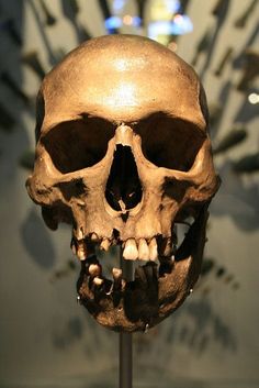 a human skull on display in a museum