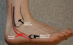 Self Muscle Massage - Foot Athletes Training, Muscle Massage, Muscle Anatomy, Massage Benefits, Medical Anatomy, Massage Techniques, Foot Health, Sports Medicine, Reflexology