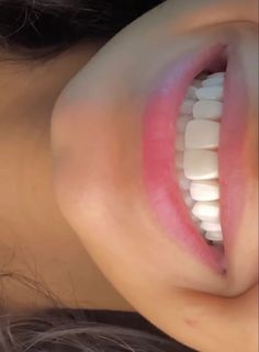 Teeth Aesthetic, Pretty Teeth, Wish Board, Perfect Teeth