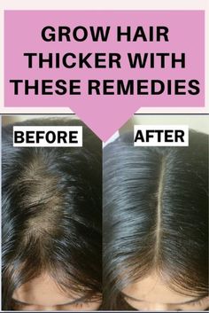 Do you know Some home remedies will grow your hair and makes it thicker naturally, sometimes you need natural medicines which make also natural hair regrow. Hair Fall Remedy Home Natural, Hair Lose Control, Stop Hair Shedding, Remedies For Healthy Hair, Hair Fall Remedies, Soft Glam Wedding Makeup Brides, Hair Fall Remedy Home, Stop Hairfall, Hair Fall Control Tips