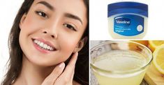 Par conséquent, dans cette note, je vous propose d'utiliser la vaseline, le citron et la vitamine E , sont les ingrédients parfaits pour avoir un visage nickel. Winter Lip Balm, Vaseline Original, Petroleum Jelly, Unwanted Hair Removal, Unwanted Hair, Planting Herbs, Natural Wellness, Vaseline