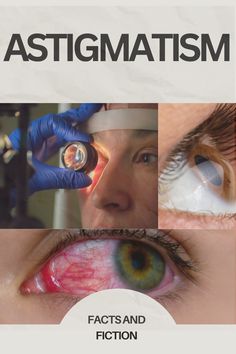 It's time to demystify astigmatism! In this insightful exploration, we'll separate fact from fiction, debunk common myths, and equip you with all the essential knowledge you need to take control of your eye health. Discover the truth about astigmatism and learn how to navigate this common vision impairment with confidence and clarity. Daily Headaches, Ghost Images, Eye Doctor, Common Myths