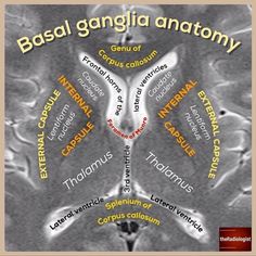 an image of the brain with words in different languages on it, including captions