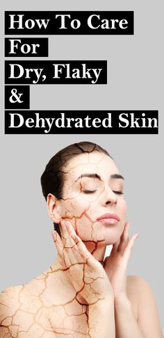 How To Hydrate Face Dry Skin, What Helps Dry Skin On Face, How To Take Care Of Dry Skin, How To Get Clear Skin For Dry Skin, Natural Face Mask For Dry Skin, Diy Dry Skin Face Mask, Causes Of Dry Skin, Remedy For Dry Skin On Face