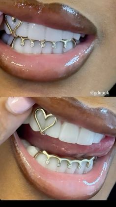 Girl Grillz, Cochella Outfits, Teeth Gems, Pretty Teeth, Dental Jewelry, Grillz Teeth, Xoxo Jewelry, Diamond Teeth, Dope Jewelry Accessories