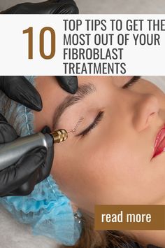 Plasma Pen Fibroblast Mapping, Fibroblast Before And After Eyes, Fibroblast Plasma Skin Tightening, Fat Dissolving Injections, Fibroblast Plasma, Plasma Fibroblast, Skin Tightening Procedures, Beauty Maintenance, Plasma Pen