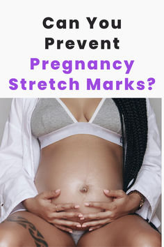 Can you prevent stretch marks during pregnancy? Why does the skin with stretch marks itch? Are stretch marks genetic?
Motherhood and pregnancy comes with a few (usually, a lot of) changes to our bodies, one of the most common being stretch marks. These subtle lines on the skin can raise big and not-so-subtle questions. Here are some answers to the most commonly asked and searched questions.