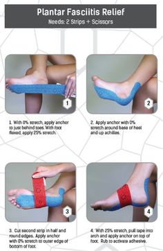 How To Get Rid Of Planters Fasciitis, Planters Fasciitis Taping, Tape Planter Facitis, How To Put Kt Tape On Ankle, Remedies For Planters Fasciitis, Planter Fasciitis Taping, Kt Tape Plantar Facitis, How To Strap An Ankle Injury, Planters Facitis Relief