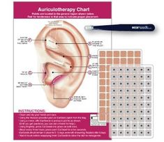 Ear Seed Placement, Ear Acupressure Points, Headache Chart, Acupressure Headache, Ear Seeds, Thai Yoga Massage, Cool Ear Piercings, Energy Medicine, Acupuncture Points