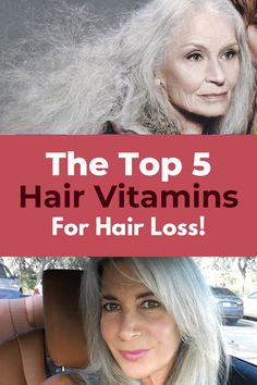 Best Hair Vitamins, Vitamins For Hair, Everyday Hair, Vitamins For Hair Growth, Hair Help, Hair Vitamins, Hair Remedies, Best Hair, Hair Health