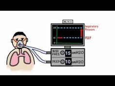 a cartoon drawing of a man with oxygen in his mouth and thermometer on his chest