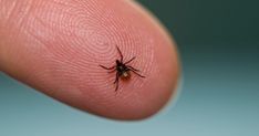 Tick season is here. Here's how to remove and dispose of one safely. Get Rid Of Ticks, Types Of Ticks, Rash Causes, Deer Ticks, Tick Bite, Tick Removal, Tick Prevention, Chronic Fatigue, Support Group