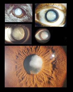 four different pictures of an eye with the iris opened and showing light coming through it