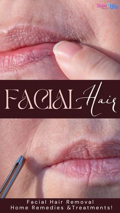 Is facial hair making you lose your confidence? Don’t worry! Check out this article to learn how to remove facial hair using different home remedies and treatments! Hair Home Remedies, To Remove Facial Hair, Upper Lip Hair, Facial Hair Growth, Remove Unwanted Facial Hair, Remove Unwanted Hair, Natural Face Cleanser