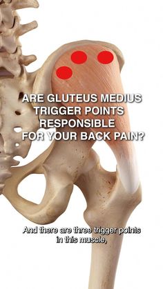 Iliac Crest, Punkty Spustowe, Hip Anatomy, Physical Therapy Assistant, Massage Therapy Techniques, Basic Anatomy And Physiology, Yoga Anatomy, Gluteus Medius, Trigger Point Therapy