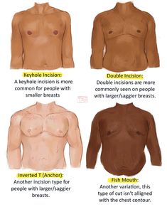 Enemies To Lovers Pose Reference, Enemies To Lovers Poses, Top Surgery Art, Ftm Tips, Top Surgery Scars, Top Surgery, Body Reference Drawing