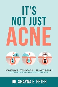 Do you feel like you've tried everything for acne and have been left feeling frustrated and helpless? Have you forgotten what it's like to have clear skin? Have you wondered if you'll have to deal with acne for the rest of your life? Are you tired of being on an endless hamster wheel of one treatment after the next and trying every new skincare product that comes out? Are you tired of guessing? Would you like to understand what's going on in your body and have real answers? Wouldn't it be great Blind Pimple, Forehead Acne, Pimples Under The Skin, Skin Diet, Boost Immunity, Feeling Frustrated, Clearer Skin, Immune Boosting, Skin Care Acne