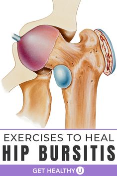 the hip is shown with text that reads exercises to heal hip bursitiss get healthy